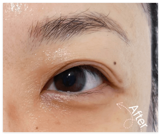 提拉靡甦緊緻課程